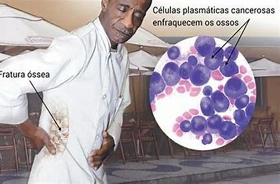 Imagem das Células Cancerosas